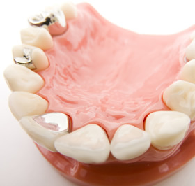 一般・審美歯科の治療費用についてのご案内