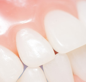 歯周病の治療についてのご案内