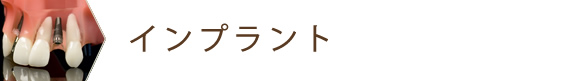 インプラント